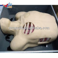 ISO Pleural Drainage Manikin, Pneumothorax Dekompression, Bildungsmodell